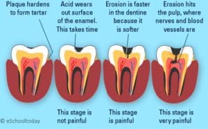 The Important Relationship Between Teeth and Nutrition Is Explained ...