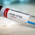Testing,For,Presence,Of,Coronavirus.,Tube,Containing,A,Swab,Sample